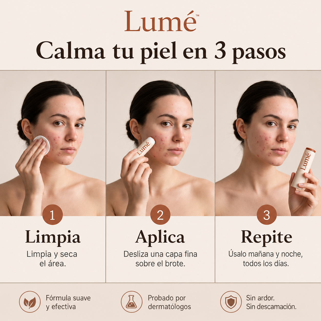 Stick Lumé ™ Elimina Acné y Enrojecimiento en pocos días + Ebook de regalo 🎁