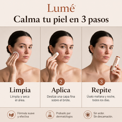 Stick Lumé ™ Elimina Acné y Enrojecimiento en pocos días + Ebook de regalo 🎁