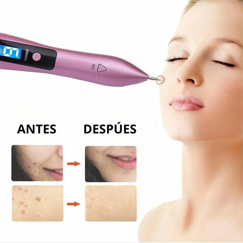 DERMAZEN™ ELIMINA VERRUGAS EN SEGUNDOS + ENVIO GRATIS + EBOOK DE REGALO 🎁